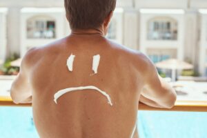 Sad smile painted on the man back with sunscreen. Sunburn protection concept