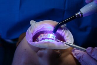 découvrez les meilleures techniques et solutions pour le whitening de vos dents : conseils, produits, et recommandations pour un sourire éclatant en toute sécurité.