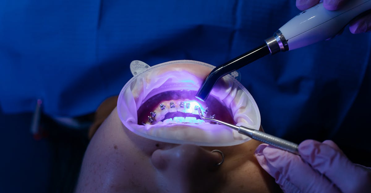 découvrez les meilleures techniques et solutions pour le whitening de vos dents : conseils, produits, et recommandations pour un sourire éclatant en toute sécurité.