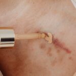 découvrez des idées de tatouages pour cacher vos cicatrices avec style et créativité. nos designs de scar cover-up tattoo allient esthétisme et camouflage parfait.