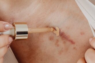 découvrez des idées de tatouages pour cacher vos cicatrices avec style et créativité. nos designs de scar cover-up tattoo allient esthétisme et camouflage parfait.