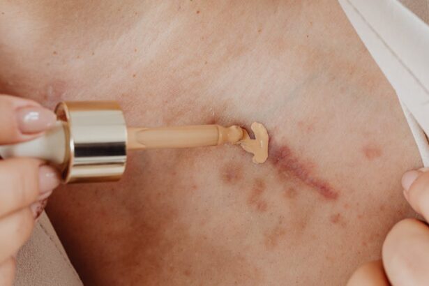 découvrez des idées de tatouages pour cacher vos cicatrices avec style et créativité. nos designs de scar cover-up tattoo allient esthétisme et camouflage parfait.