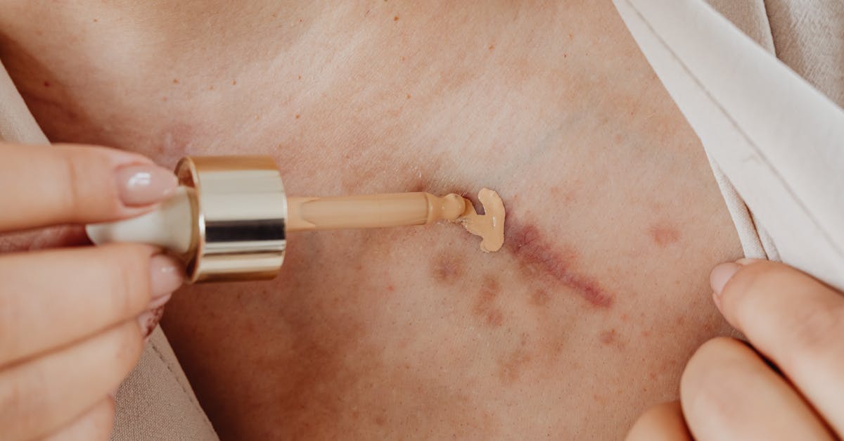 découvrez des idées de tatouages pour cacher vos cicatrices avec style et créativité. nos designs de scar cover-up tattoo allient esthétisme et camouflage parfait.